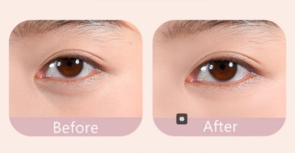 GOGOTALES Acne Marks Dark Circles Concealer 3.4g 戈戈舞沁润无痕遮瑕液