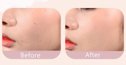 GOGOTALES Acne Marks Dark Circles Concealer 3.4g 戈戈舞沁润无痕遮瑕液